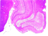 Fig_13_alf_amygdala Fig_13_alf_amygdala
