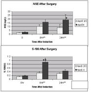 Nse_s100_edited Nse_s100_edited